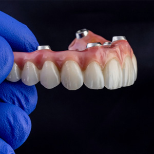 Gloved hand holding implant denture for upper arch