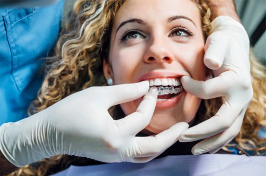 Straighten your smile with SureSmile aligners near Villa Park